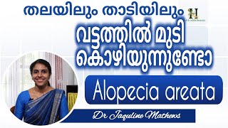 Alopecia areata | വട്ടത്തിലുള്ള മുടികൊഴിച്ചിൽ ശ്രദ്ധിക്കുക | Dr Jaquline Mathews BAMS