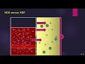 prof. hesham elsayed hdx versus hdf part 1