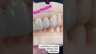 Check out our LayZir Multilayer Monolithic Zirconia! 🤩