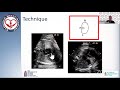 9 •determination of situs in fetal life foramen ovale in fetal circ understanding of fetal doppler