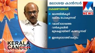 Doctor's Talk  : DR Muhammad Iqbal on colorectal Cancer  | Manorama News