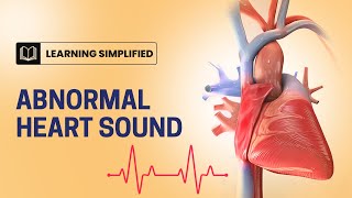 The Abnormal Sounds Auscultated In Various Heart Pathologies | Learning Simplifies #neetpg #fmge