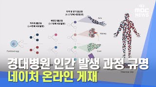 [대구MBC뉴스] 경대병원 인간 발생 과정 규명 네이처 온라인 게재