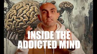 Inside the Addict's Brain: Why Addiction Changes How You Think