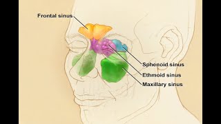 Medical management of chronic sinusitis