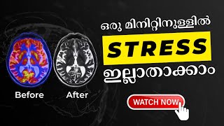 ഒരു മിനിറ്റിനുള്ളിൽ Stress ഇല്ലാതാക്കാം #Malayalam