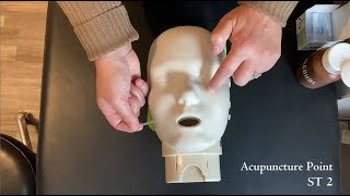 McMaster Medical Acupuncture Program: Acupuncture Point ST 2