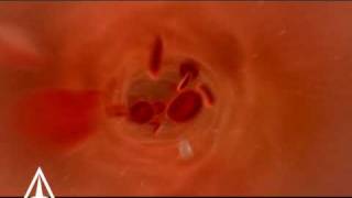 Amerra 3D Medical Visualization - Demo Trailer 2009