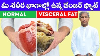 How Can Reduce Visceral Fat ? | ( Hidden Fat ) | Dr Manthena Satyanarayana Raju Videos | GOOD HEALTH