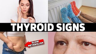 HYPOTHYROIDISM: Don’t Ignore These 7 Early Warning Signs