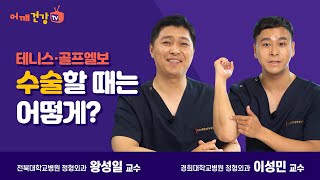 테니스/골프 엘보 수술할 때는 어떻게?