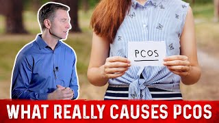 What Really Causes PCOS (Polycystic Ovarian Syndrome) – Dr. Berg