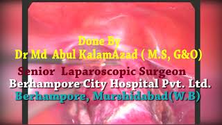 TOATL LAPAROSCOPIC HYSTERECTOMY