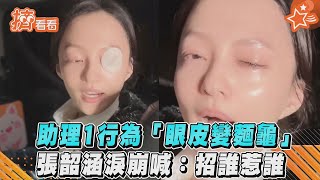 助理1行為「眼皮變麵龜」　張韶涵淚崩喊：招誰惹誰