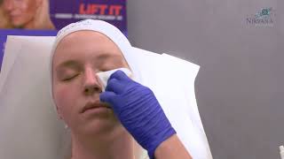 Biznct - Injectables (Filler) - Medical Spa Marketing - Digital \u0026 Video Marketing