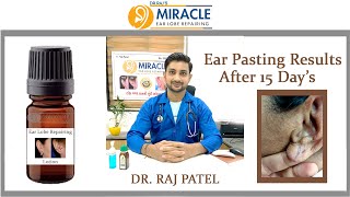 Ear Pasting Lotion Available Torn Ear lobe / Hole Repair by Ear Pasting lotion  -Call - 9687889595