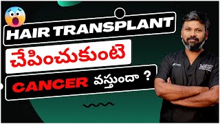 #AskDrJohnWatts | HAIR TRANSPLANT చెపించుకుంటే CANCER వస్తుందా ? | Hair Specialist Explains