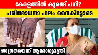 കേരളത്തിൽ കുരങ്ങ് വസൂരിയെന്ന് സംശയം | *Health