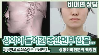 (SUB) 상악이 들어간 중안면부 함몰입니다. [비대면상담 275] / It is a mid-face depression with the maxilla indented.