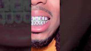 QUAVO MIGOS NEW ICED OUT GRILL RICH RAPPER LIFESTYLE QUAVO
