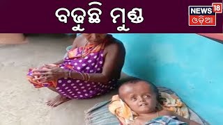 ଅସହାୟ ପରିବାରକୁ ଦୁଃଖ ଦେଉଛି ଅଜଣା ରୋଗ