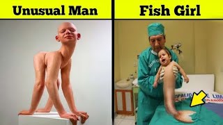 Most Unusual People Ever Born On Earth | Alzone TV