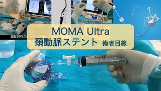 MOMA Ultra 頚動脈ステント（CAS）術者目線