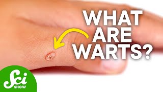 Do Toads Actually Give You Warts? | The Truth About Warts \u0026 How to Get Rid of Them