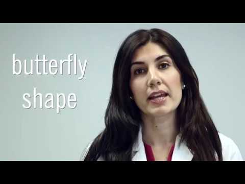 What is the test for hyperthyroidism?