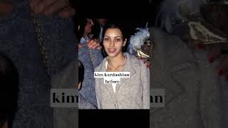 kardashians before and after surgery #shorts #edit #kardashian #kylie  #kimkardashian  #kendall
