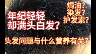 年纪轻轻却满头白发？