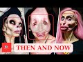 20 Celebrity Plastic Surgery Disasters | Then and Now 2024