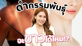 ดำกรรมพันธุ์ ดำแดด ขาวได้ไหม!!