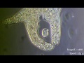 Amoeba eats  paramecia ( Amoeba's lunch ) [ Amoeba Endocytosis / Phagocytosis  Part 1 ] 👌