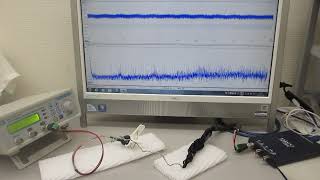 超音波プローブの伝搬特性に基づいた、超音波システムの開発技術（ultrasonic-labo）