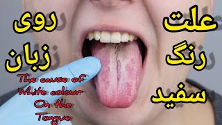 علت رنگ سفید روی زبان:the cause of the white color on the tongue