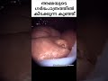 അമ്മയുടെ വയറിനുള്ളിൽ കിടക്കുന്ന കുഞ്ഞിന്റെ real video pregnancytips trending ytshorts pregnant