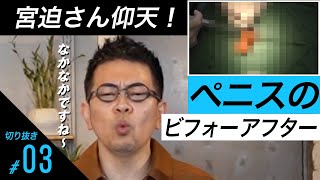 【コラボ企画】宮迫さん驚愕!?動画で観る包茎手術!!