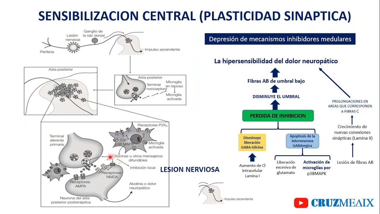 Fisiopatología Del Dolor Parte 02: Sensibilización Periférica Y Central ...