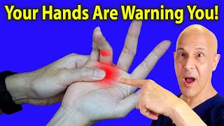 15 Alarming Signs in Your Hands You Shouldn’t Ignore!  Dr. Mandell