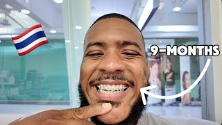 Day Vlog: 9-Months With Braces Update...I'm Loving the Progress! Bangkok 🇹🇭