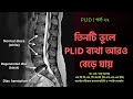 PLID 22 | তিনটি ভুলে PLID ব্যথা আরও বেড়ে যায় | 3 Mistakes More PLID Pain | Doctor Shah Alam