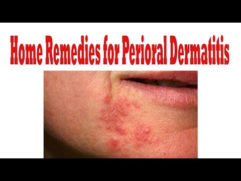 How to Cure Perioral Dermatitis || how to get rid of perioral dermatitis How to Cure Perioral Dermatitis || how to get rid of perioral dermatitis