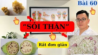 SỎI THẬN, 7 ngày loại bỏ ngay tại nhà rất đơn giản | Ds Nguyễn Quốc Tuấn