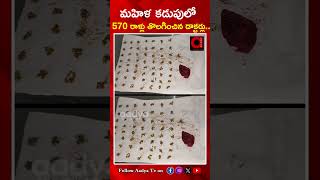 మహిళ కడుపులో 570 చూసి షాక్ అయిన డాక్టర్లు | 570 Stones In women Stoamch | AADYA TV