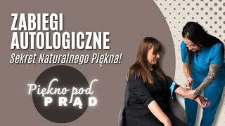 Zabiegi Autologiczne: Sekret Naturalnego Piękna!