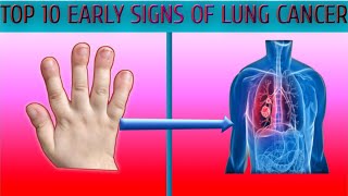 Top 10 early signs of lung cancer | health care 1
