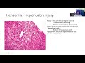 The role of Liver biopsy in liver transplantation Lecture by Professor Janaki Hewavisenthi