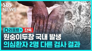 [단독] 국내 원숭이두창 의심 환자 2명…1명 1차 양성, 1명 음성 / SBS / #D리포트