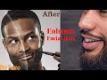 Follicle Booster Beard Pen | How to Increase Beard Growth Naturally